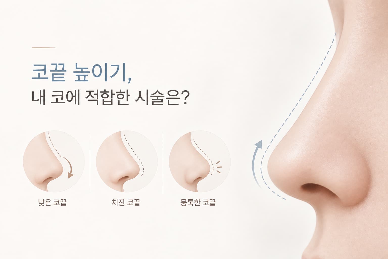 코끝 높이기_코 유형에 따라 어떤 시술을 선택해야 할까