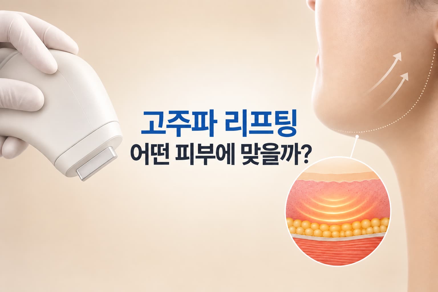고주파 리프팅은 어떤 피부에 맞을까_적합 대상과 주의 대상