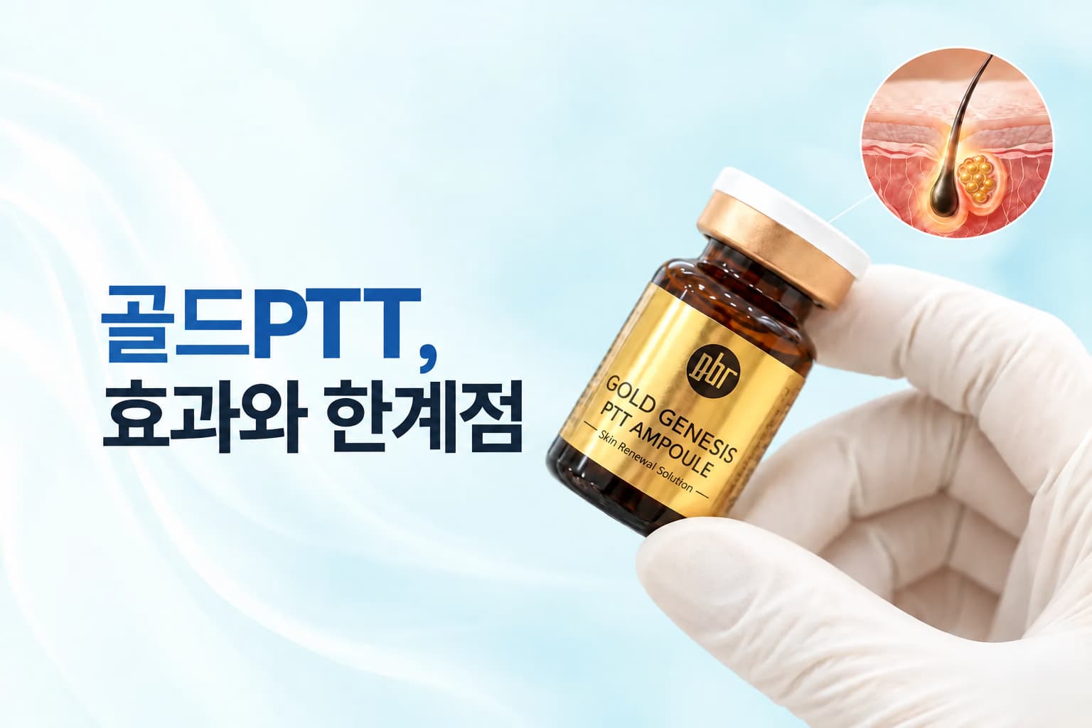 골드PTT 효과는 어디까지일까_여드름 재발 억제 원리와 한계