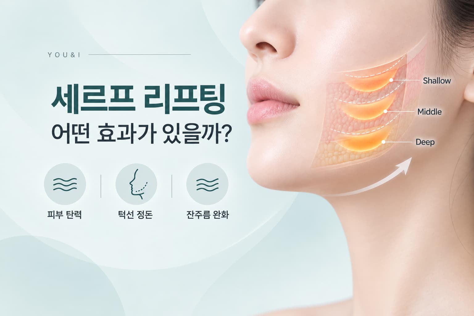 세르프 리프팅, 어떤 효과를 기대할 수 있을까_유앤아이의원 선릉점