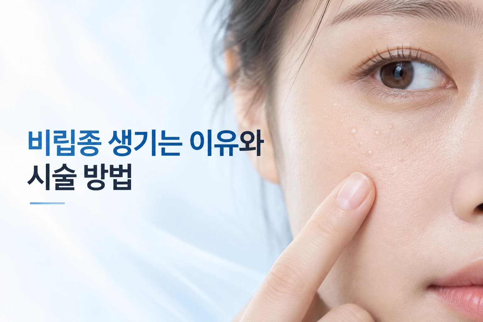 비립종 생기는 이유와 좁쌀여드름 차이_올바른 제거 방법
